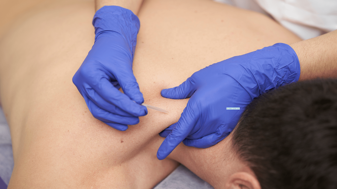 Dry Needling
